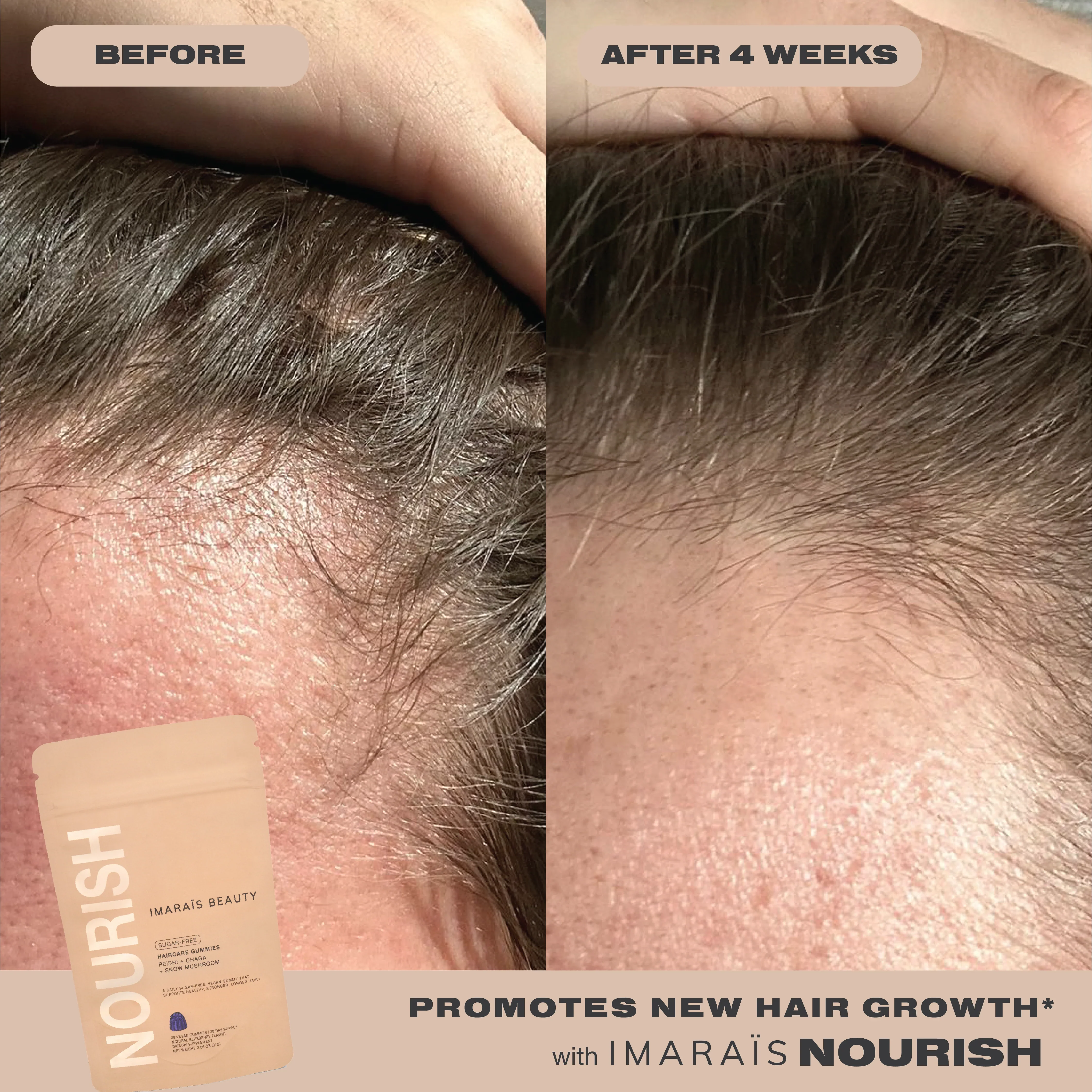 IMARAÏS Beauty Nourish - Image 6
