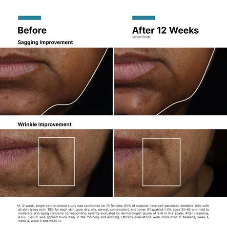 SkinCeuticals A.G.E. Interrupter Ultra Serum - Image 2