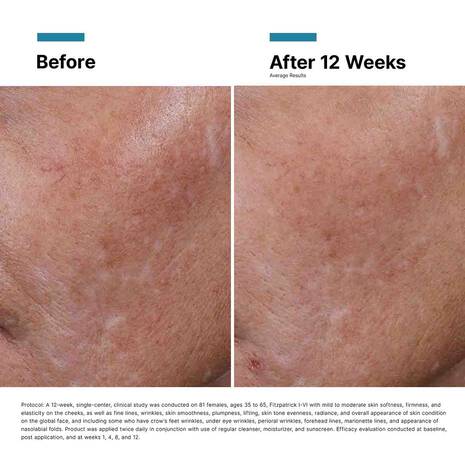 SkinCeuticals H. A. Intensifier Multi-Glycan - Image 8