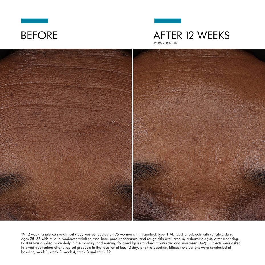 SkinCeuticals P-Tiox Serum - Image 3
