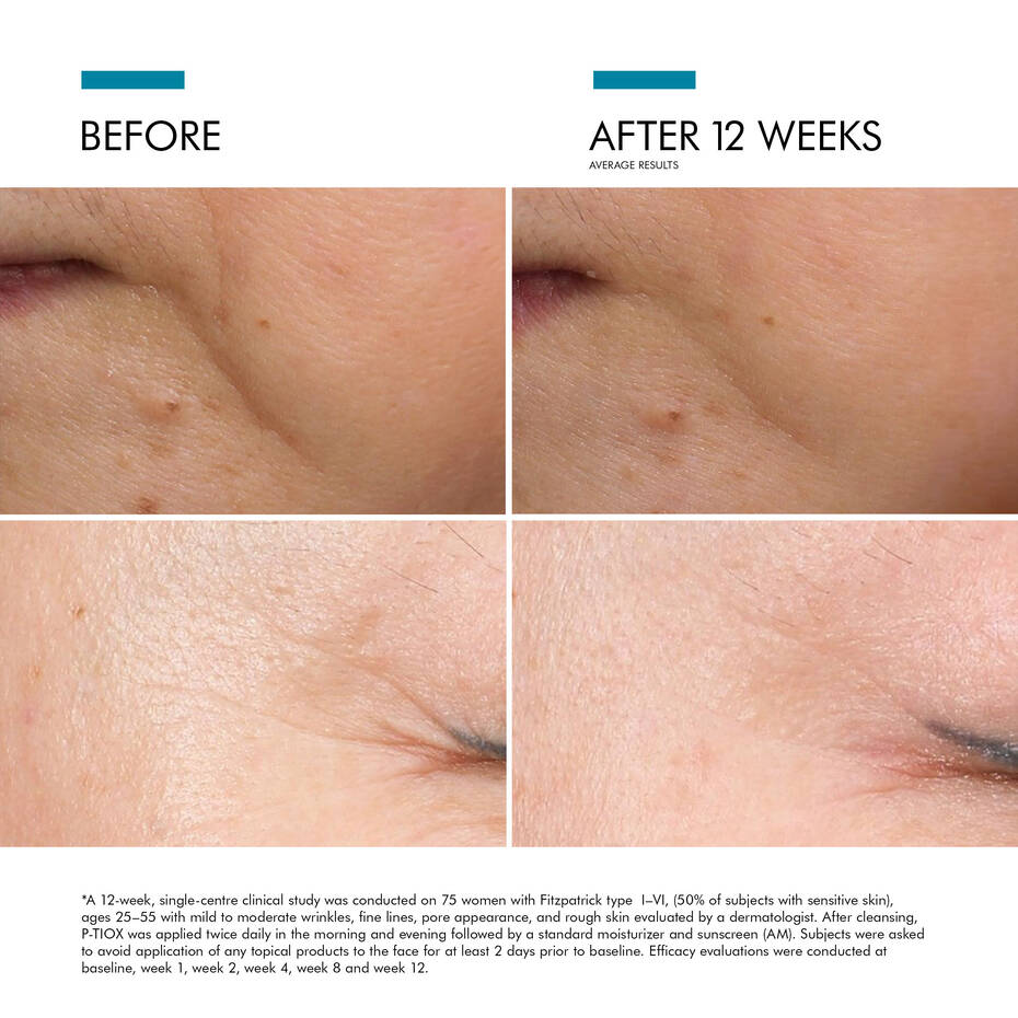 SkinCeuticals P-Tiox Serum - Image 4