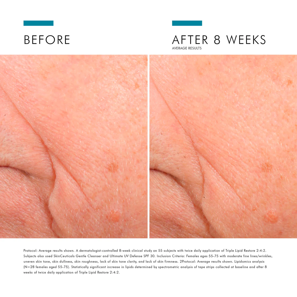SkinCeuticals Triple Lipid Restore 2:4:2 - Image 3